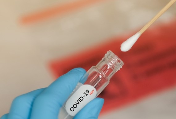 4 662 са новите случаи на коронавирус у нас за последните